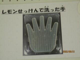 remon2