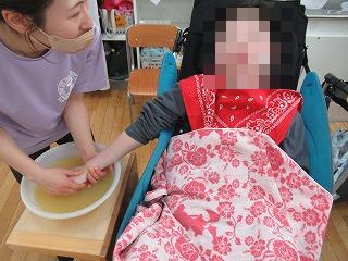 手